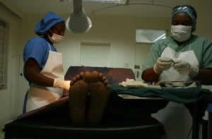circumsion-1