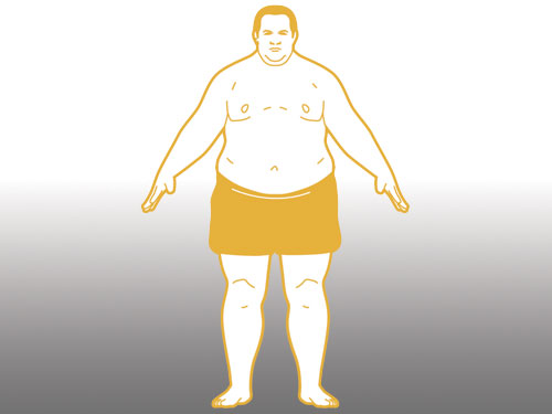 Heavyset body type