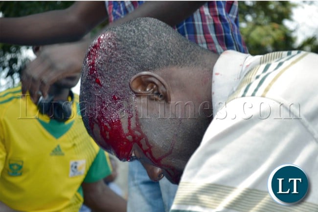A plain clothes police officer bleeds from a head injury after he was attacked by suspected UPND cadres at Woodlands police station