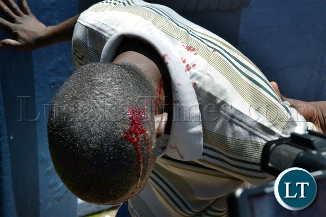A plain clothes police officer bleeds from a head injury after he was attacked by suspected UPND cadres at Woodlands police station