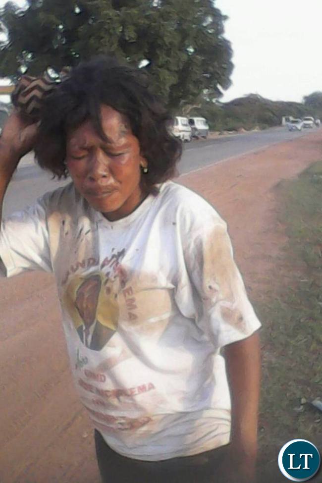 A female UPND supporters who was caught up in the fracas