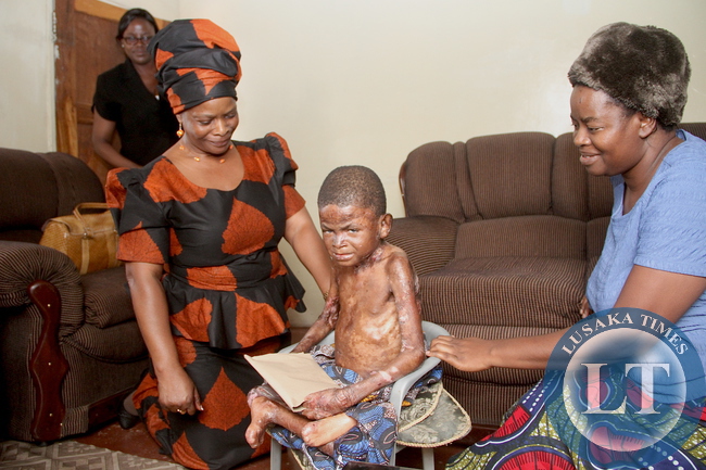 First Lady when she visited 9 year-old Joshua Mulikelela suffering from genetic skin disorder in Lusaka's Kaunda square on Saturday, December 5,2015 . Looking on is Joshua's mother Stella -Pictures by THOMAS NSAMA