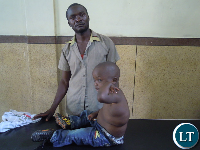 Mwape Mubanga with his son Joseph Mubanga showing the affected part that has been attacked by unknown disease. PICTURE: RACKSON SHAMUTUKU