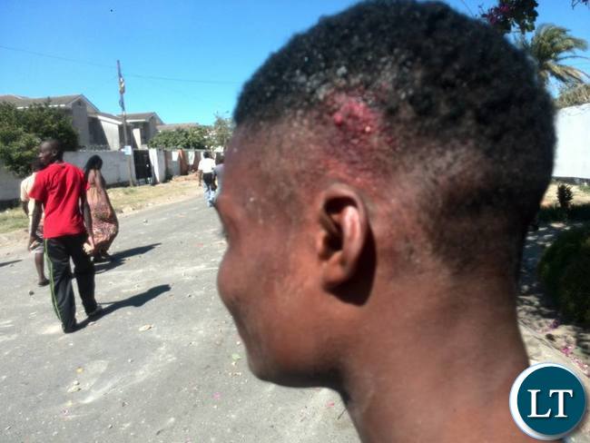 Some of the cadres injured in the attacks
