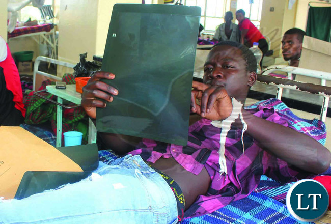 NSAMA Bwalya, an illegal gemstone miner of Lufwanyama district nursing gunshot wounds in Kitwe Teaching Hospital yesterday. PICTURE: NKOMBO KACHEMBA NSAMA Bwalya, an illegal gemstone miner of Lufwanyama district nursing gunshot wounds in Kitwe Teaching Hospital yesterday. PICTURE: NKOMBO KACHEMBA