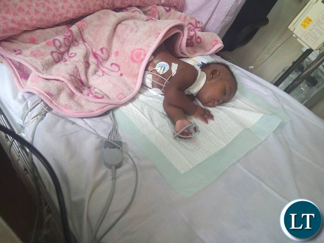 Latest pictures of Mapalo and Bupe recovering in the ICH.