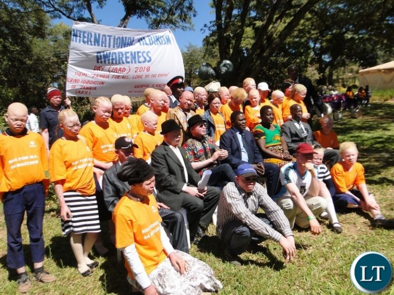 Government To Strengthen Albinism Advocacy