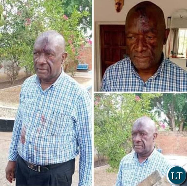 Transport Minister Condemns the beating of Sydney Mbewe by PF cadres