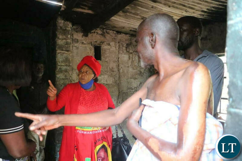 UPND Secretary General Stephen katuka accompanied by National Women Chairlady, Namakau Kabwiku to visit the victims