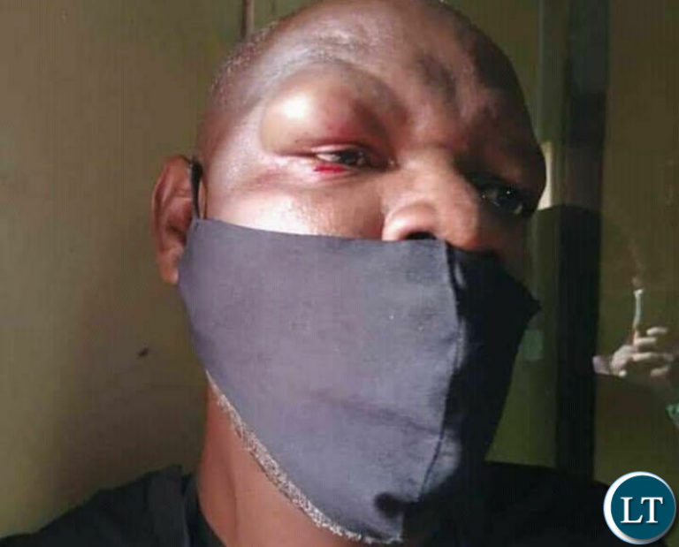 Committee to Protect Journalists urges government to thoroughly investigate the recent attack on Journalists at PF Secretariat