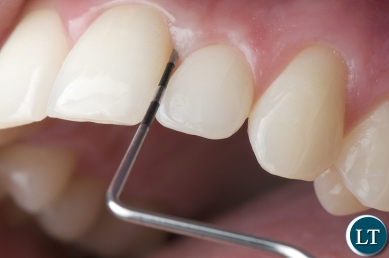 Chipangali man directed to stop  extracting people’s teeth using traditional methods