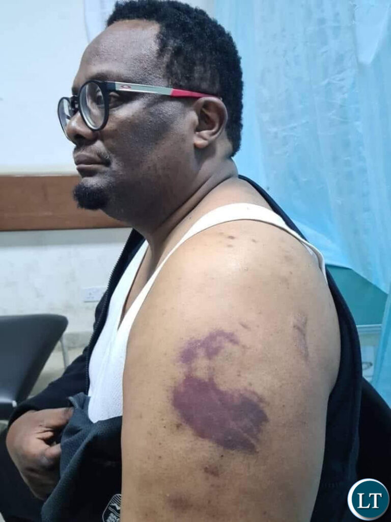 Opposition Leaders Express Concern Over Human Rights Abuses in Zambia