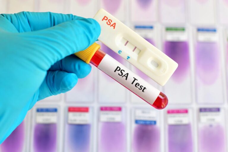 PCCZ Cautions Men on Prostate Cancer Testing: Early Detection Key to Survival