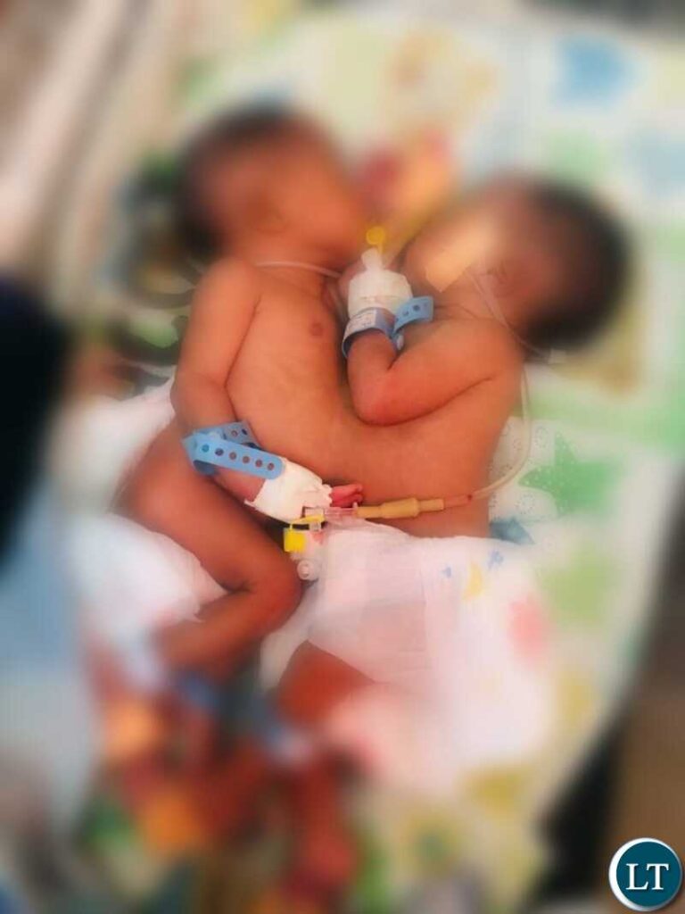 Zambia Flying Doctor Service Successfully Evacuates Conjoined Twins