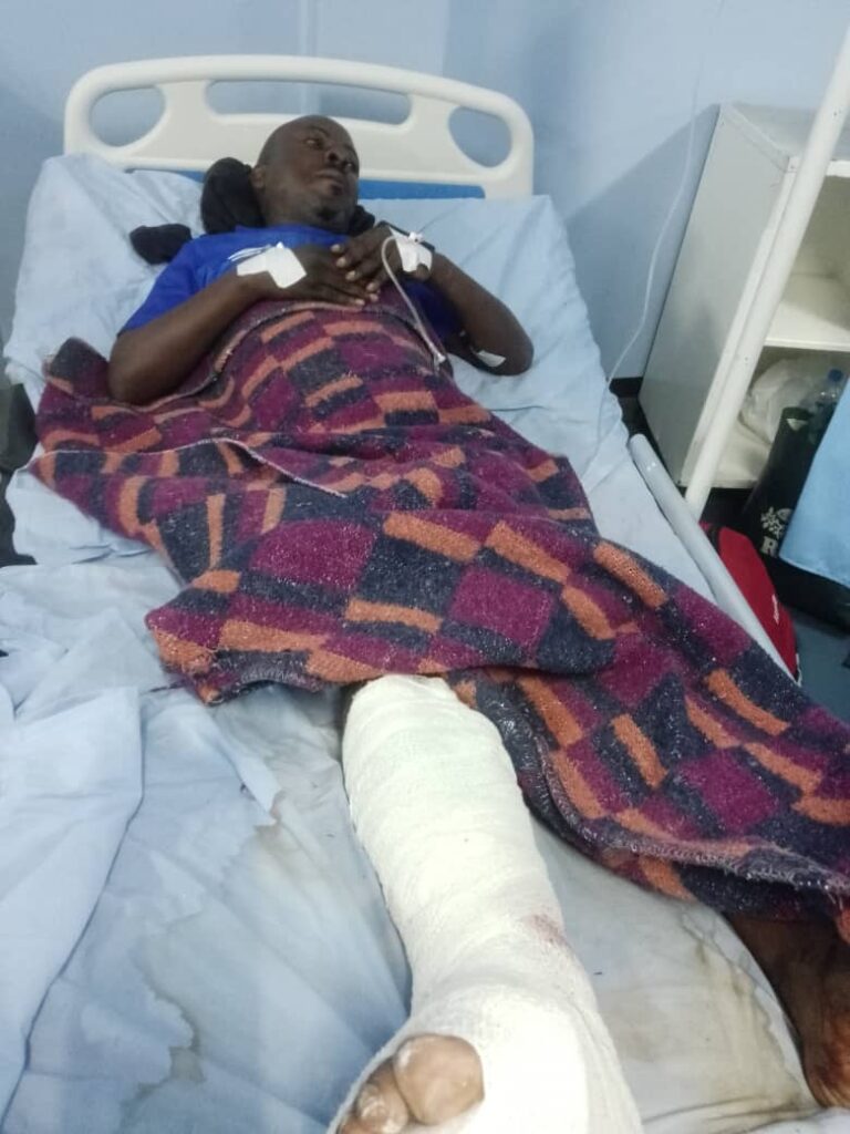 Police Crowd Control Before Chipolopolo Kickoff Leaves Fan Injured