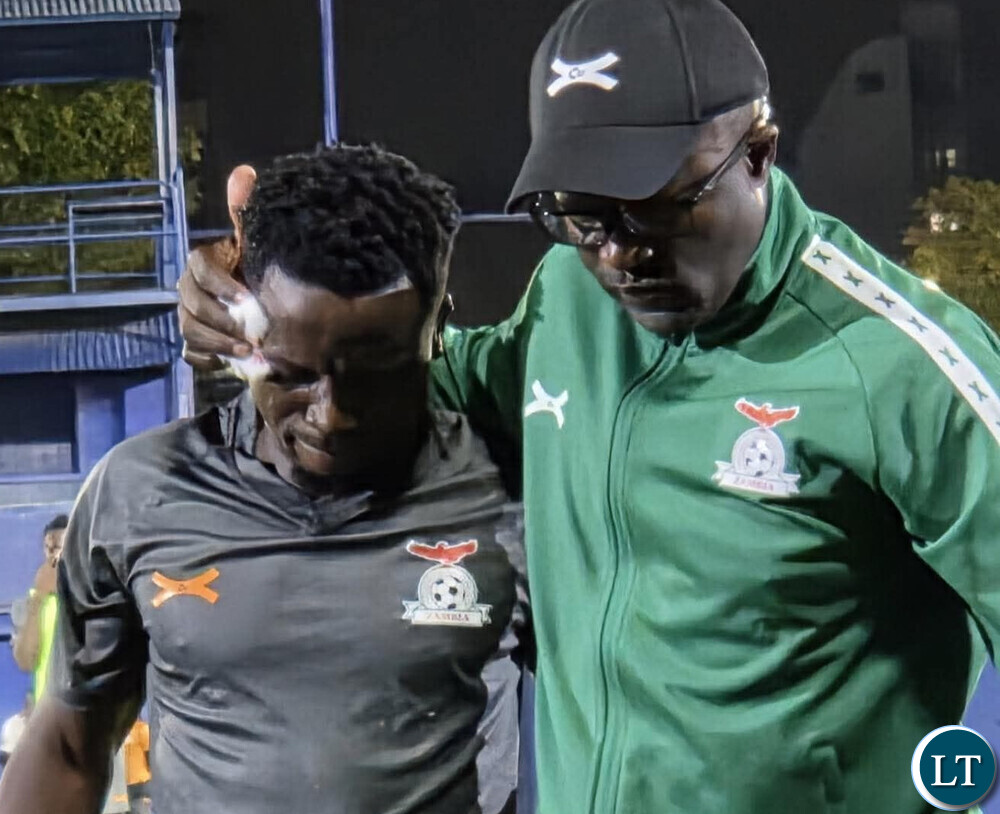 Mumba Suffers Facial Injury Ahead of Argentina Friendly
