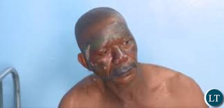 Eight Workers Injured in Chambishi Explosion