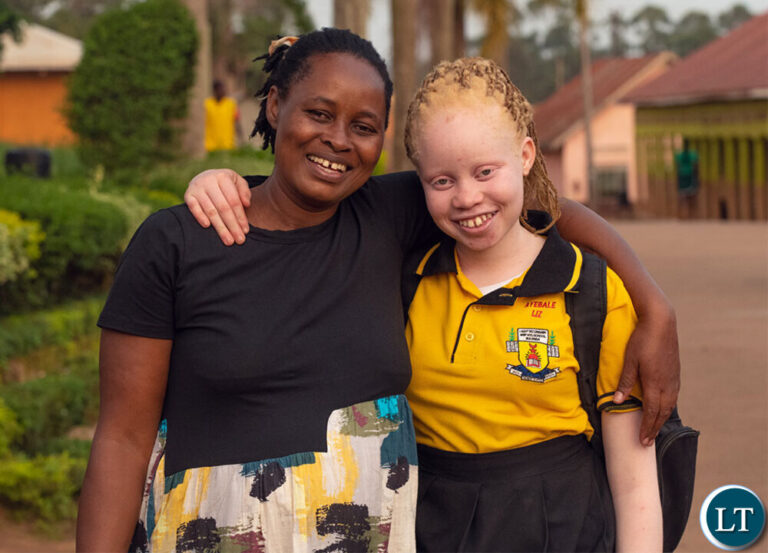 Government unveils action plan promoting albinism protection and inclusion